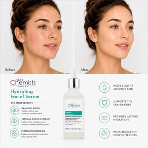 skinChemists Sérum facial para piel sensible con 5 % de Sangre de Dragón y 3 % de Centella Asiática, 30 ml.