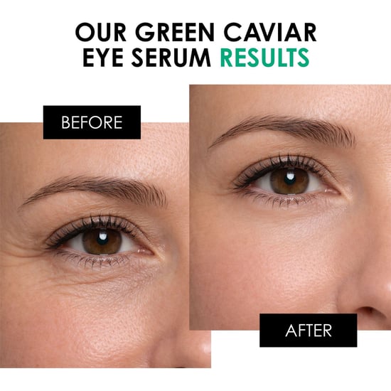 skinChemists Sérum contorno de ojos antiedad con caviar verde 15 ml - Image 3