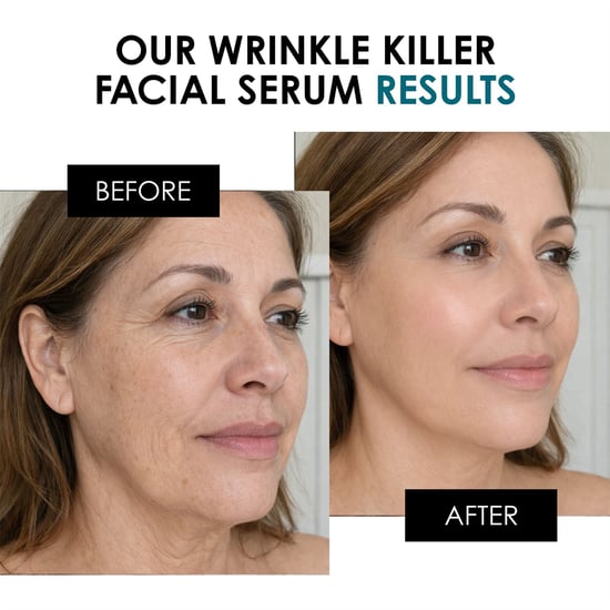 skinChemists Sérum facial antiarrugas Wrinkle Killer 30 ml - Image 3
